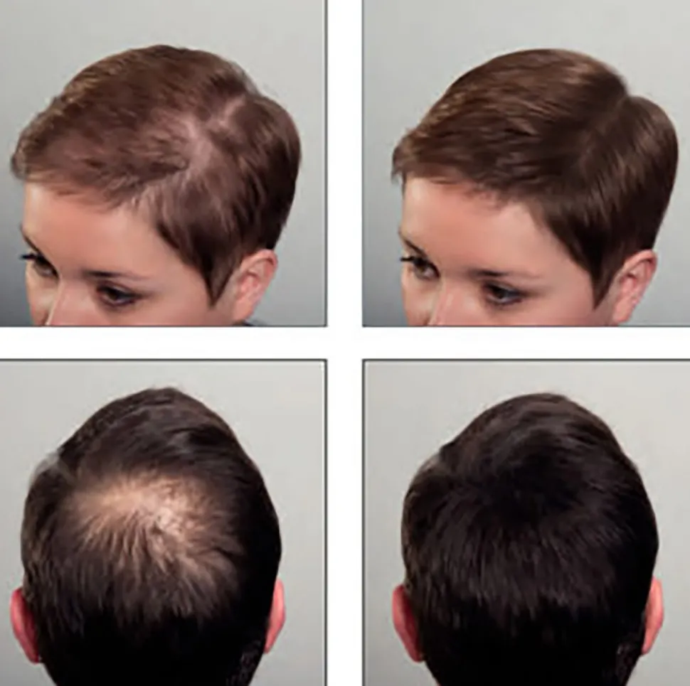 Sibel - Hair Sculptor Hair Building Fibers Dark Blonde 25 g