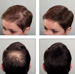 Supreme Trimmer Black HairThik Hair Fibers Kit 25g